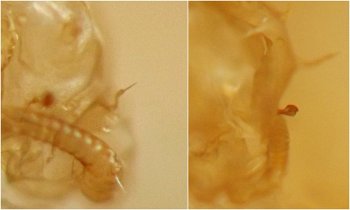 one structure is a reddish bulb on a short stalk, the other is a thin tubelike spine